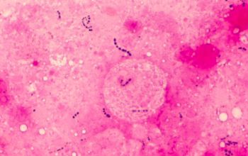 Streptococcus pyogenes Gram stain