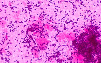 Streptococcus pyogenes Gram stain