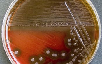 Streptococcus pyogenes Blood Agar 24h culture incubated with CO2