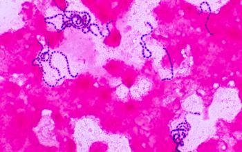 Streptococcus vestibularis Gram stain