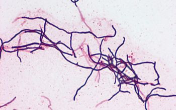 Streptomyces griseus Gram stain