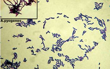 Treuperella pyogenes Gram stain