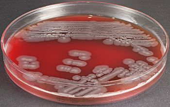 Vibrio alginolyticus Blood Agar 24h culture incubated with CO2