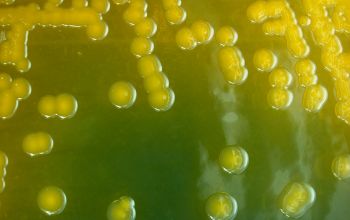 Vibrio cholerae  culture incubated with O2
