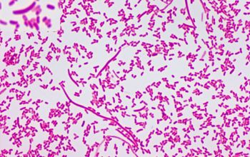 Vibrio cholerae Gram stain