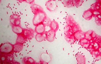 Vibrio cholerae Gram stain
