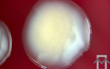 Vibrio parahaemolyticus Blood Agar 48h culture incubated with CO2