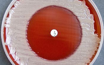 Weeksella virosa Blood Agar 24h culture incubated with O2