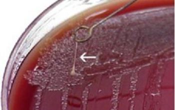 Yersinia pestis Blood Agar 48h culture incubated with CO2
