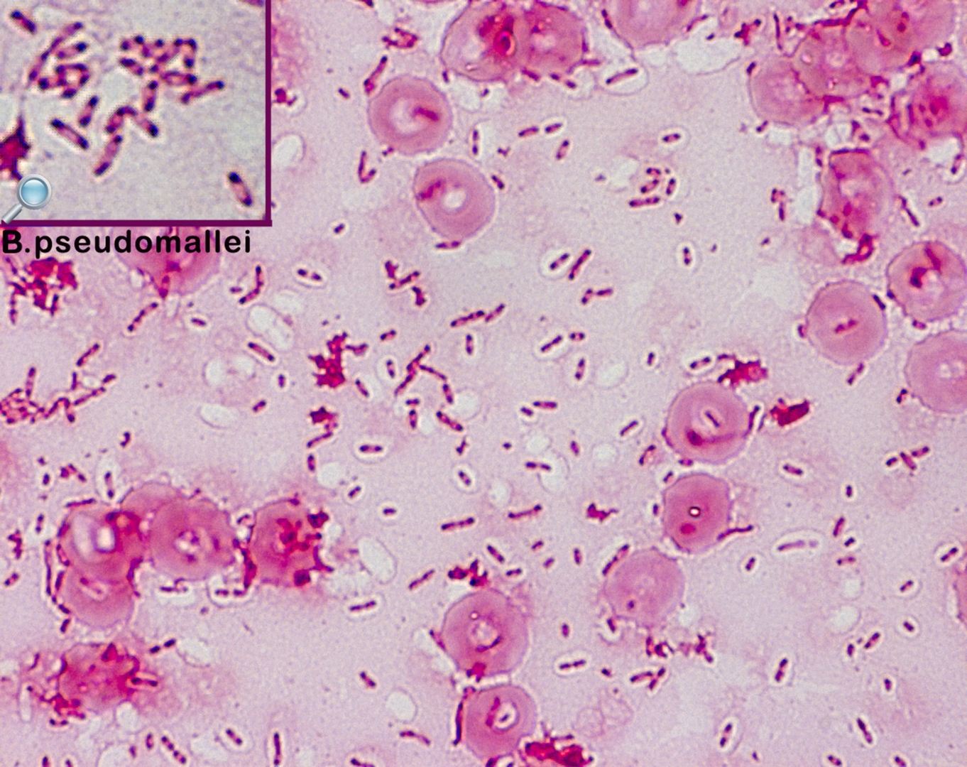 Bipolar Staining Bacteria Examples