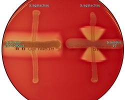 CAMP-test_Streptococcus agalactiae