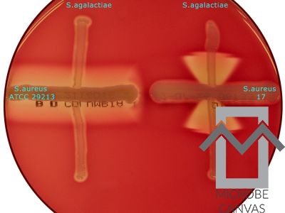 The Reverse CAMP test with Corynebacterium pseudotuberculosis and  Staphylococcus aureus on blood agar.