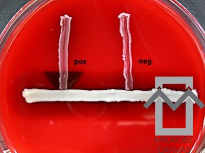 The Reverse CAMP test with Corynebacterium pseudotuberculosis and  Staphylococcus aureus on blood agar.